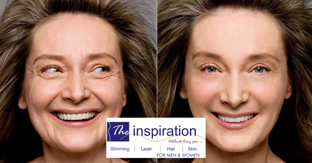 Wrinkle Treatment - The Inspiration