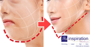Worried About Sagging Jawline? Here Is a Revolutionary Technology